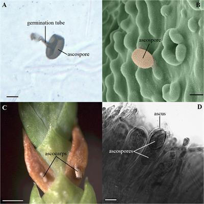 Frontiers | Histological, chemical and gene expression differences